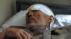 An Afghan man, one of more than 140 people injured in the Kabul embassy attack on July 7