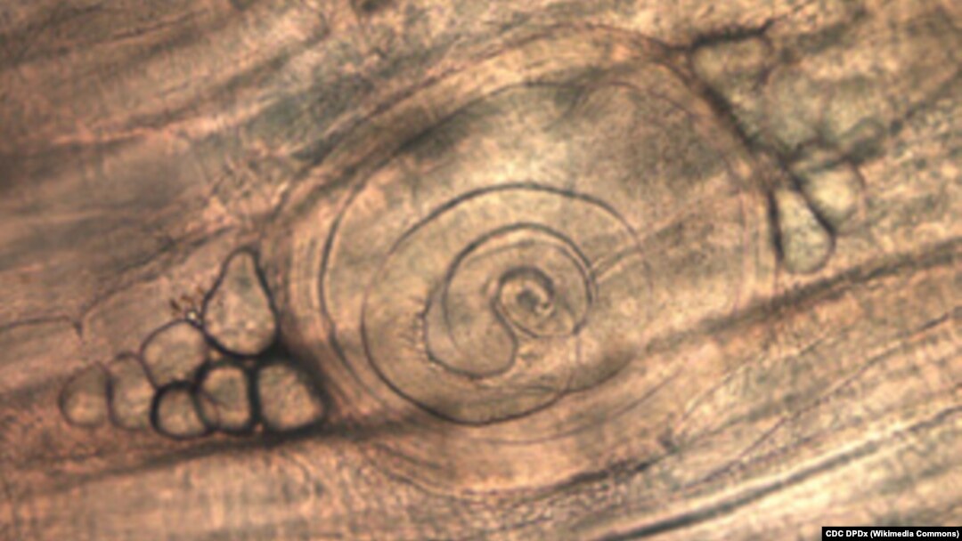 Trihinela