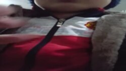 В Ташобласти воспитательница детского сада отделалась выговором за то, что избила и выбила зуб 4-летнему мальчику