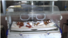 Afghanistan Seeks To Further Reduce High Maternal Mortality Rate