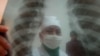 WHO Announces 'Very Good News' On Cures